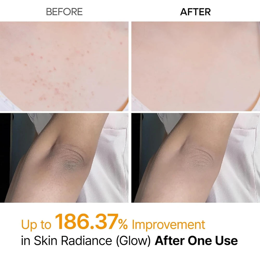 Kojic Acid Turmeric Body Exfoliator Spray