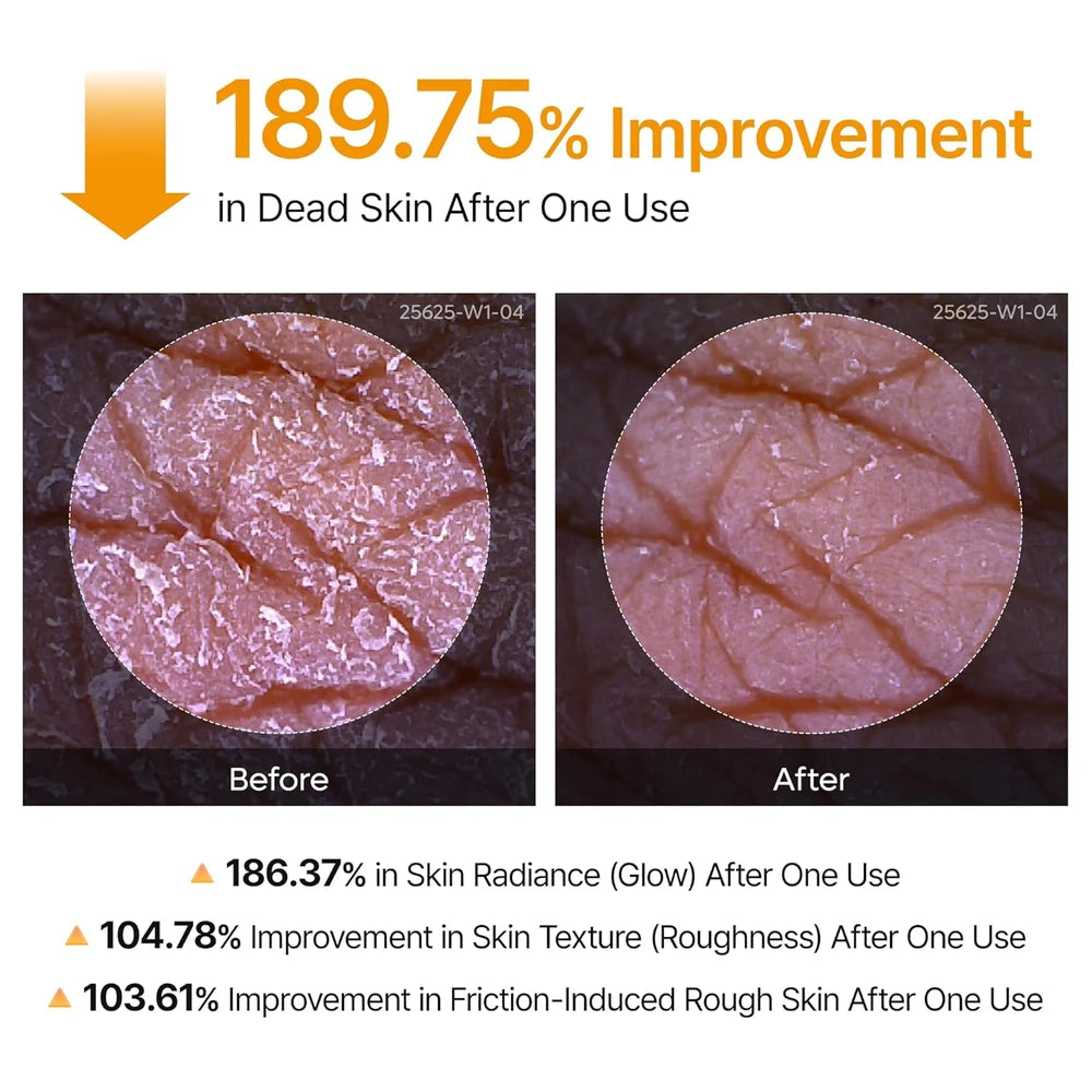 Kojic Acid Turmeric Body Exfoliator Spray