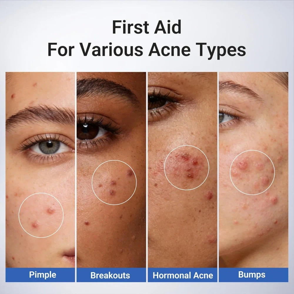 1.8% Salicylic Acid Spot Serum